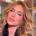 Virginia Fonseca faz tratamento laser CO2 em São Paulo contra cicatrizes de acne com subcisão e exossomos vegetais.